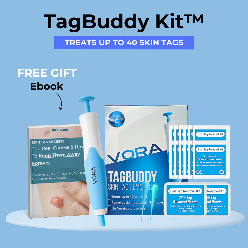 TagBuddy Kit™ – No More Skin Tags